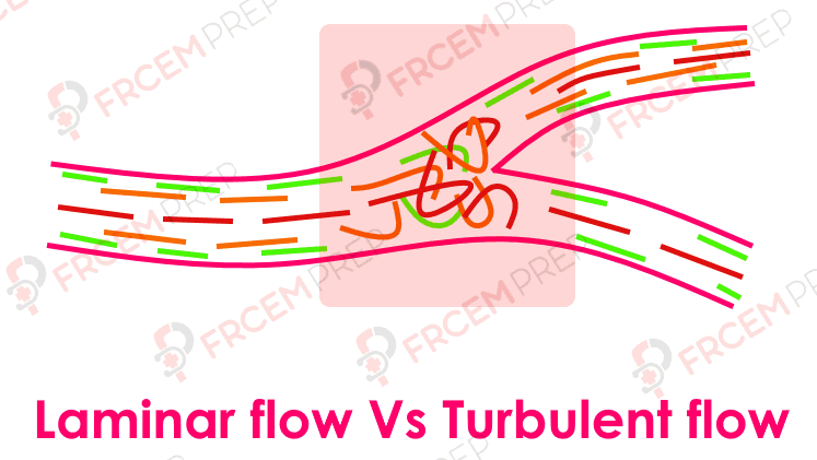 Laminar Vs turbulent flow