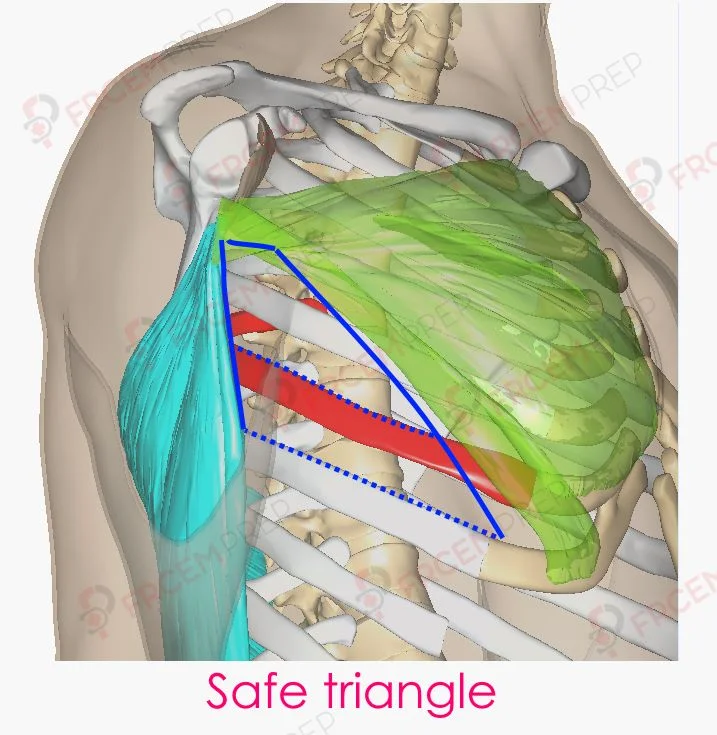 Safe triangle for chest drain placement