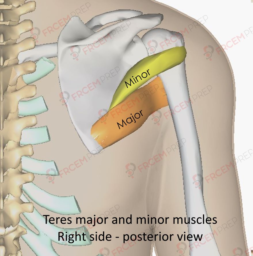 The X marks the site of the teres minor tendon insertion under the